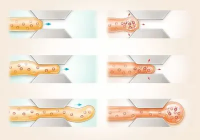 illustration of how slow-growing and fast-growing fungi grow through a narrow channel